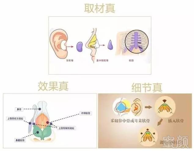 https://img.miyanlife.com/mnt/timg/190309/103HG150-11.jpg