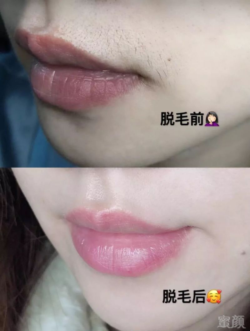 https://img.miyanlife.com/mnt/timg/190309/1052204G3-3.jpg