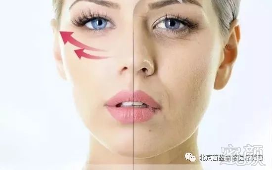 https://img.miyanlife.com/mnt/timg/190309/1055393A9-0.jpg