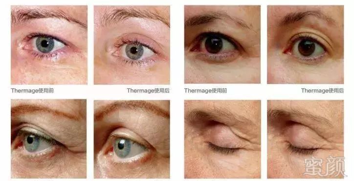 https://img.miyanlife.com/mnt/timg/190310/1224263356-10.jpg