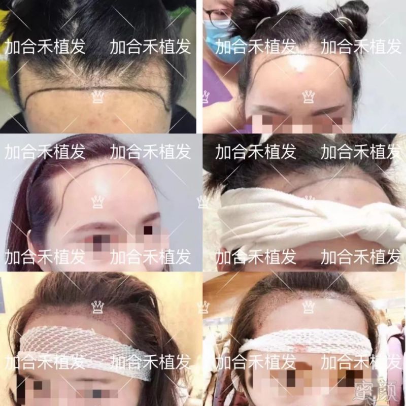 https://img.miyanlife.com/mnt/timg/190310/12444aX2-6.jpg