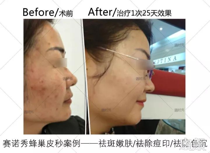 https://img.miyanlife.com/mnt/timg/190310/1254432344-8.jpg