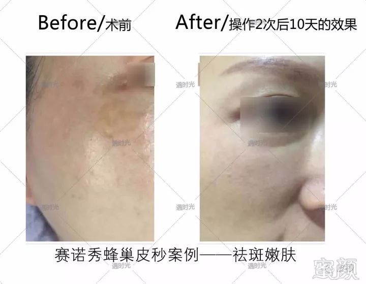 https://img.miyanlife.com/mnt/timg/190310/1254436138-7.jpg