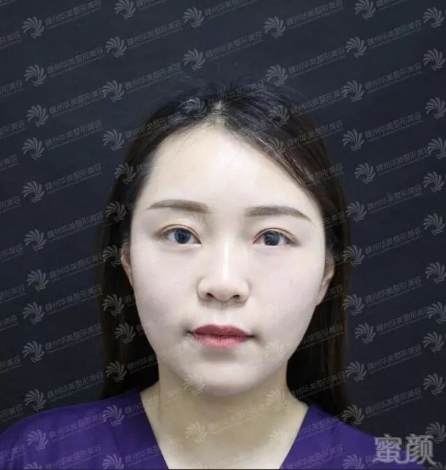 https://img.miyanlife.com/mnt/timg/190310/13291S4M-3.jpg
