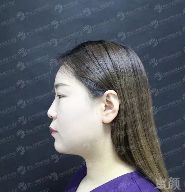 https://img.miyanlife.com/mnt/timg/190310/13291a4U-4.jpg