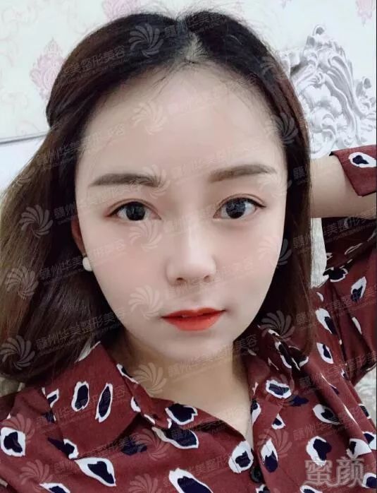 https://img.miyanlife.com/mnt/timg/190310/1329204022-5.jpg