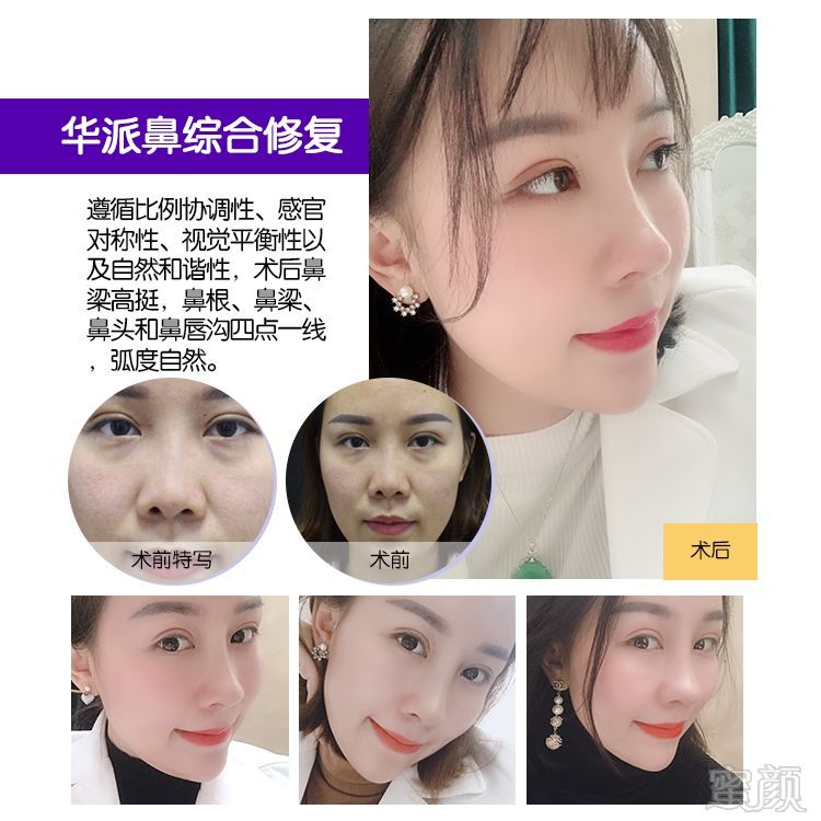 https://img.miyanlife.com/mnt/timg/190310/1329235048-9.jpg