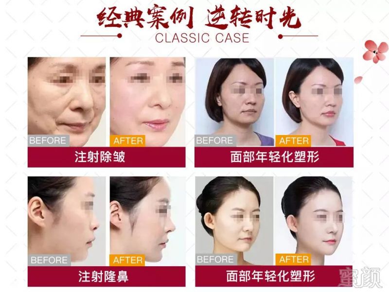 https://img.miyanlife.com/mnt/timg/190310/13344T008-8.jpg