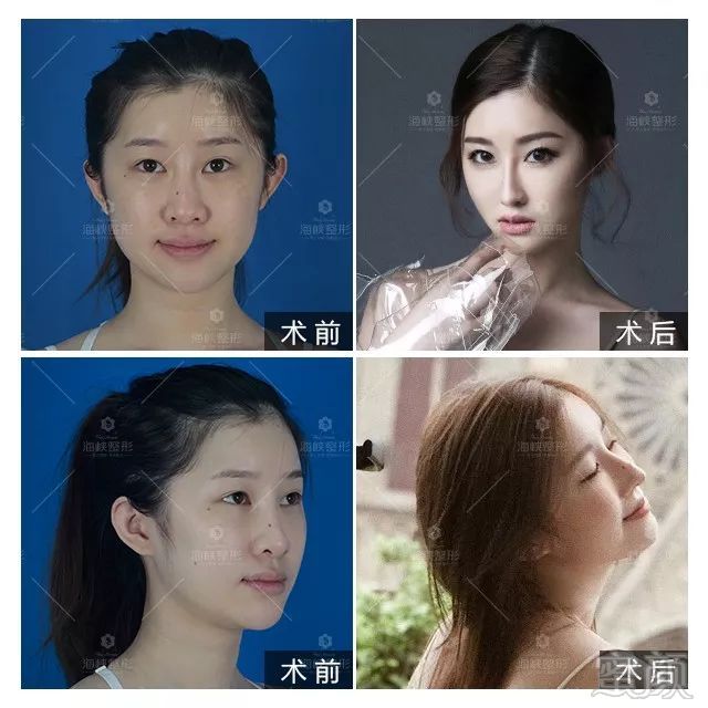 https://img.miyanlife.com/mnt/timg/190310/1350521121-0.jpg