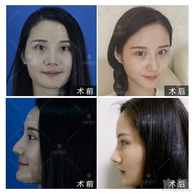 https://img.miyanlife.com/mnt/timg/190310/1350532043-2.jpg