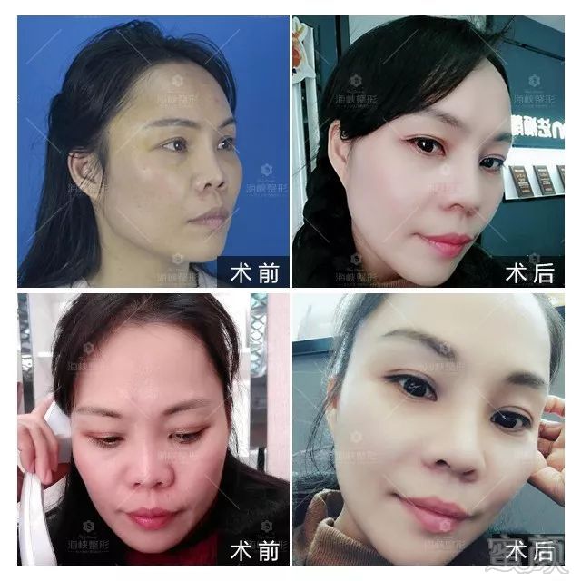 https://img.miyanlife.com/mnt/timg/190310/1350533562-1.jpg