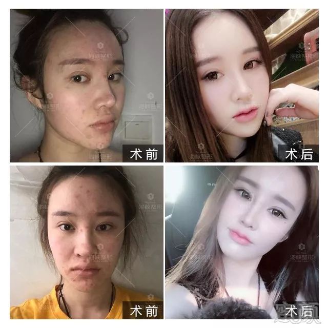 https://img.miyanlife.com/mnt/timg/190310/1350555G6-3.jpg