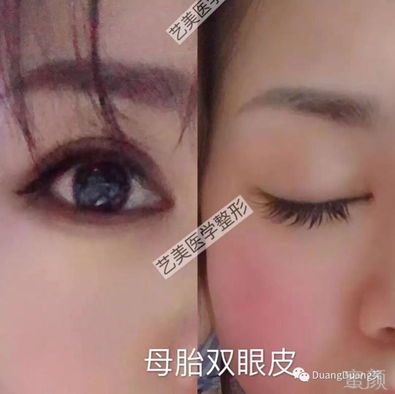 https://img.miyanlife.com/mnt/timg/190311/130R12R6-5.jpg