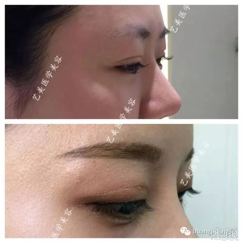https://img.miyanlife.com/mnt/timg/190311/130R22630-7.jpg
