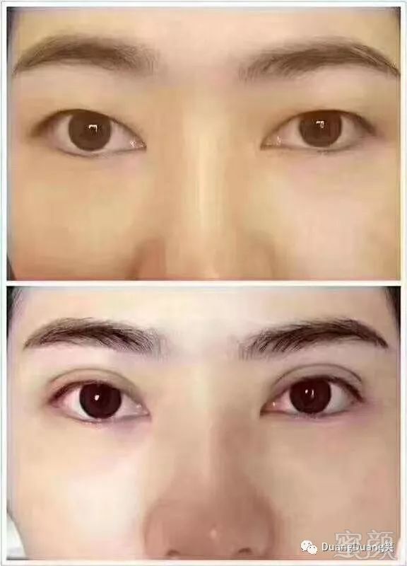 https://img.miyanlife.com/mnt/timg/190311/130R232V-6.jpg