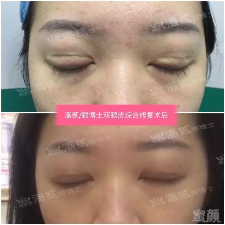 https://img.miyanlife.com/mnt/timg/190311/13163SN3-19.jpg