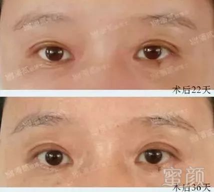https://img.miyanlife.com/mnt/timg/190311/13163U3D-16.jpg