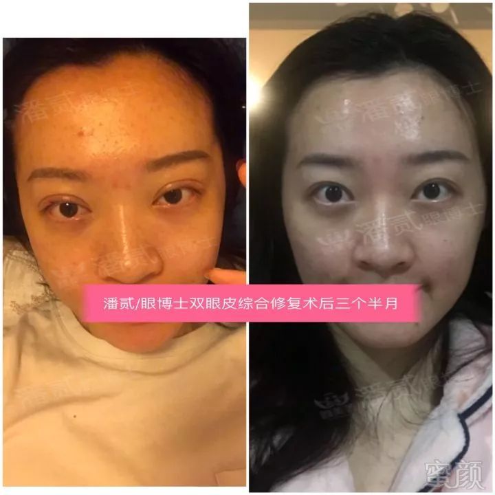 https://img.miyanlife.com/mnt/timg/190311/13163V592-18.jpg