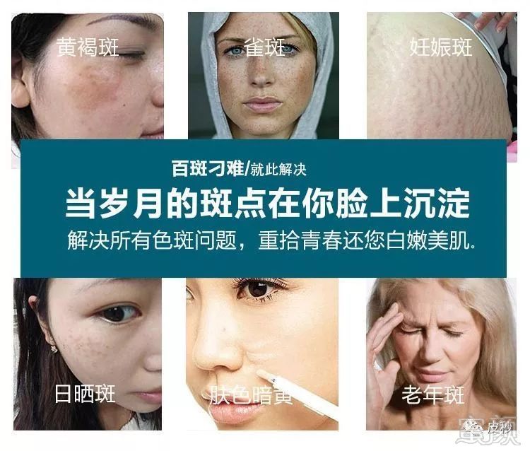 https://img.miyanlife.com/mnt/timg/190311/131PC235-0.jpg