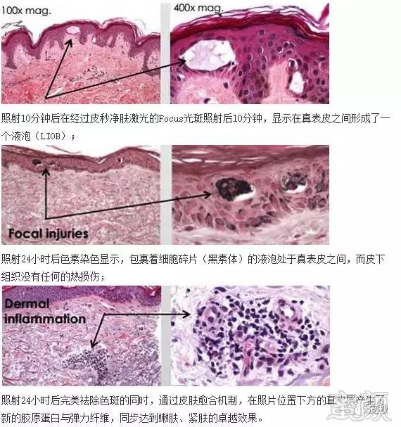 https://img.miyanlife.com/mnt/timg/190311/131Q1GU-3.jpg