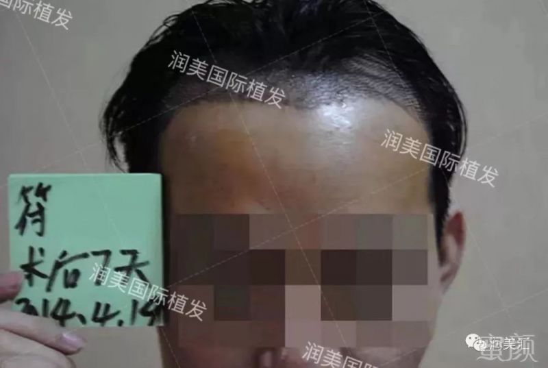 https://img.miyanlife.com/mnt/timg/190311/142514G58-6.jpg