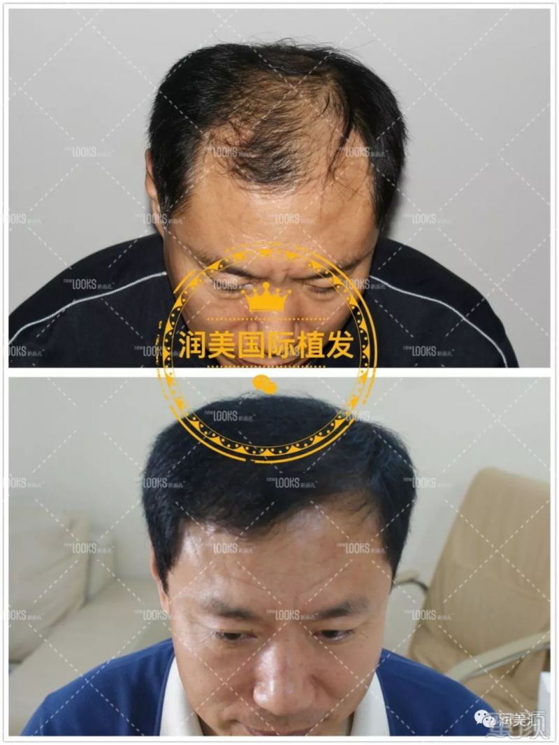https://img.miyanlife.com/mnt/timg/190311/14251A125-10.jpg