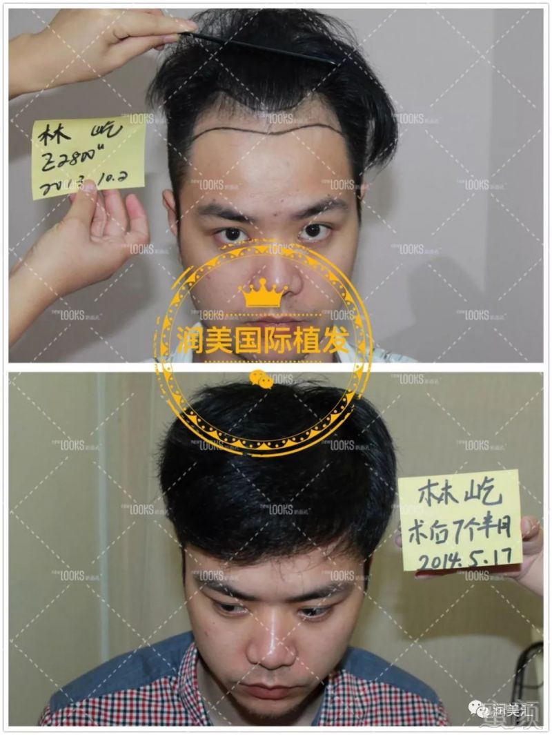 https://img.miyanlife.com/mnt/timg/190311/14251A964-11.jpg