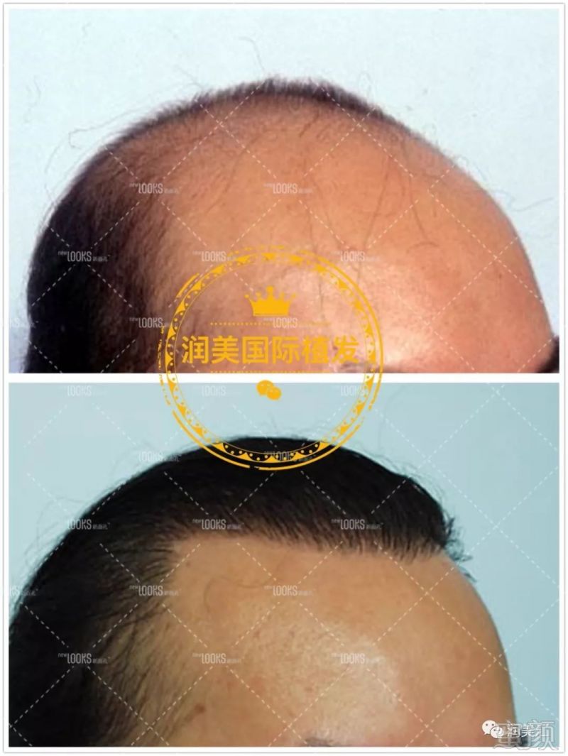 https://img.miyanlife.com/mnt/timg/190311/14251I301-13.jpg