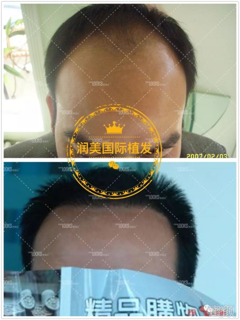 https://img.miyanlife.com/mnt/timg/190311/14251IL6-14.jpg