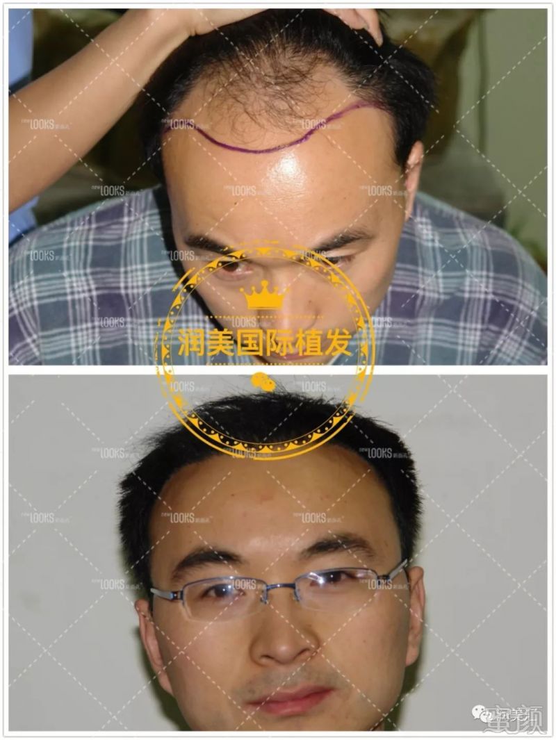 https://img.miyanlife.com/mnt/timg/190311/14251IN4-12.jpg