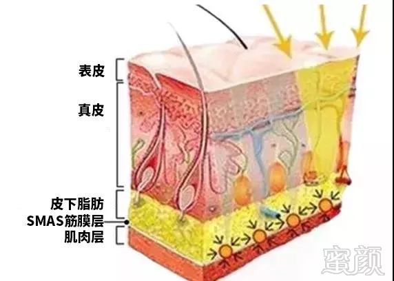 https://img.miyanlife.com/mnt/timg/190312/1334514V1-2.jpg