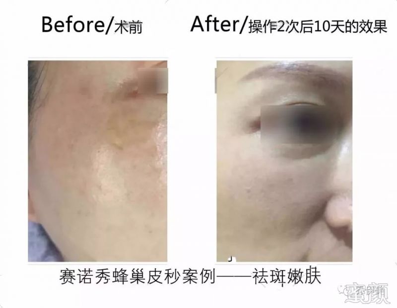 https://img.miyanlife.com/mnt/timg/190312/1421052927-7.jpg