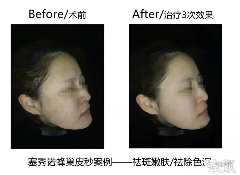 https://img.miyanlife.com/mnt/timg/190312/1421062009-9.jpg