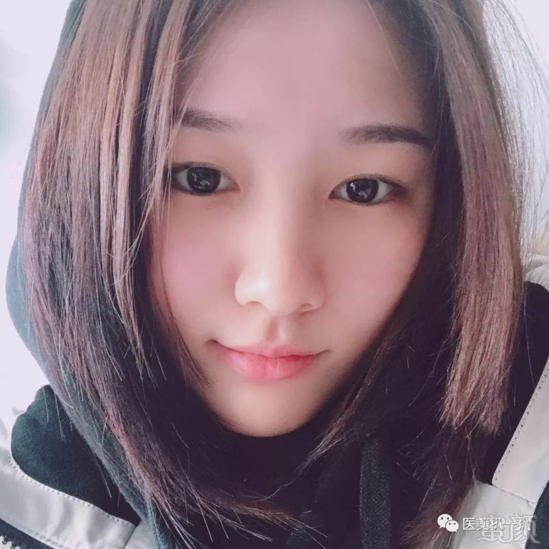 https://img.miyanlife.com/mnt/timg/190312/14220GB7-2.jpg
