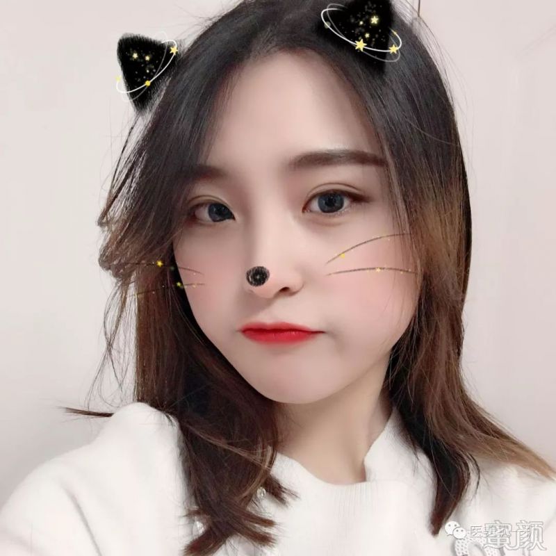 https://img.miyanlife.com/mnt/timg/190312/1425445B9-4.jpg