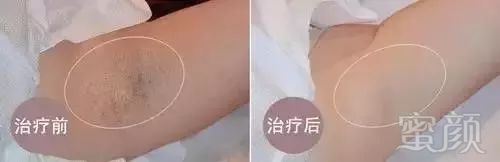 https://img.miyanlife.com/mnt/timg/190312/14455LV4-7.jpg