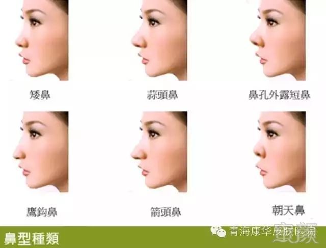 https://img.miyanlife.com/mnt/timg/190312/1450364495-2.jpg