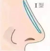 案例图片
