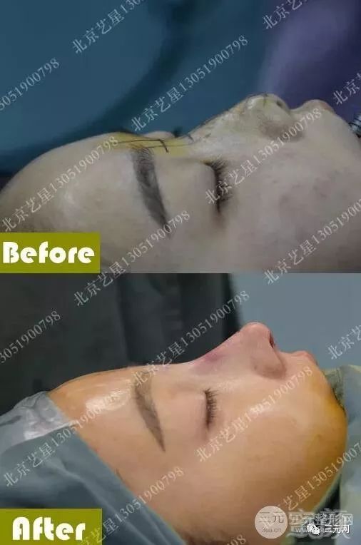 https://img.miyanlife.com/mnt/timg/190312/1513134122-5.jpg