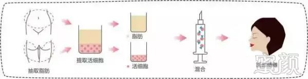 https://img.miyanlife.com/mnt/timg/190312/152ZH5N-6.jpg