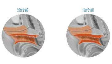 案例图片