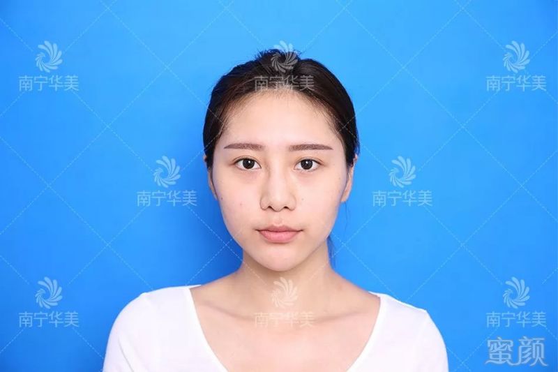 https://img.miyanlife.com/mnt/timg/190313/130R94192-0.jpg