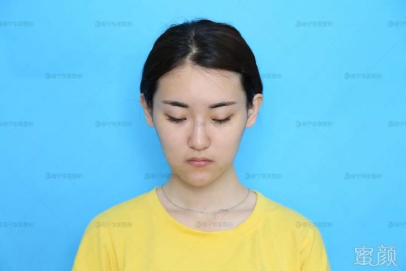 https://img.miyanlife.com/mnt/timg/190313/130S13524-4.jpg