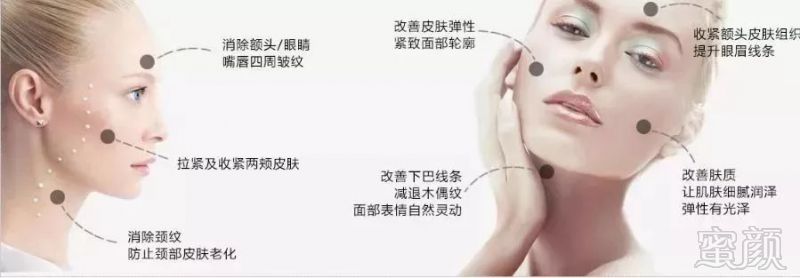 https://img.miyanlife.com/mnt/timg/190313/131I11634-4.jpg