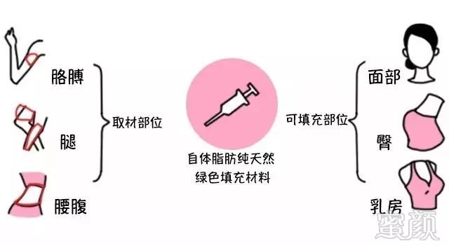 https://img.miyanlife.com/mnt/timg/190314/125US4G-3.jpg