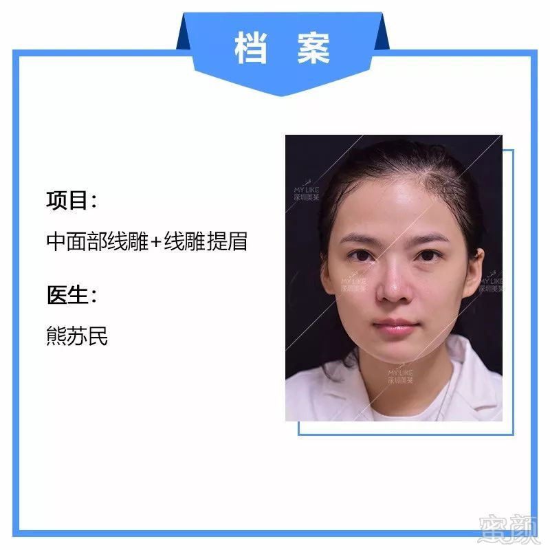 https://img.miyanlife.com/mnt/timg/190314/13231B960-1.jpg