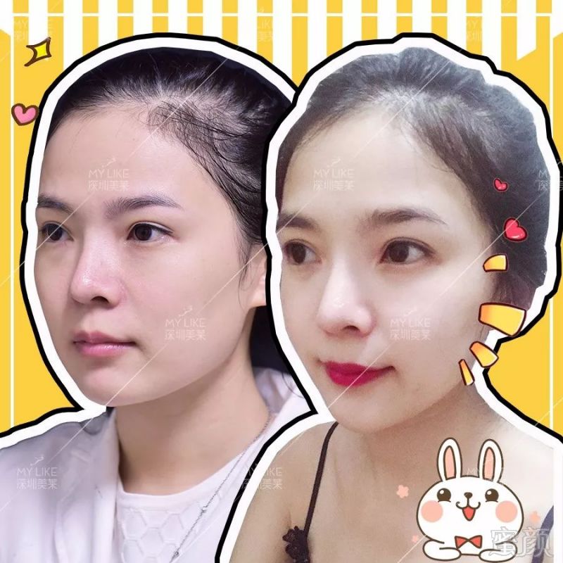 https://img.miyanlife.com/mnt/timg/190314/13231SO8-3.jpg