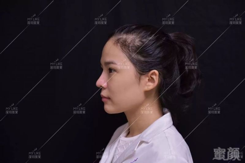 https://img.miyanlife.com/mnt/timg/190314/13232214N-7.jpg