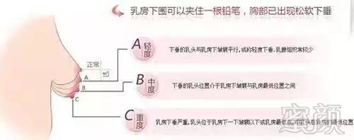 案例图片