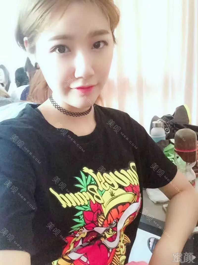 https://img.miyanlife.com/mnt/timg/190315/130F56256-1.jpg